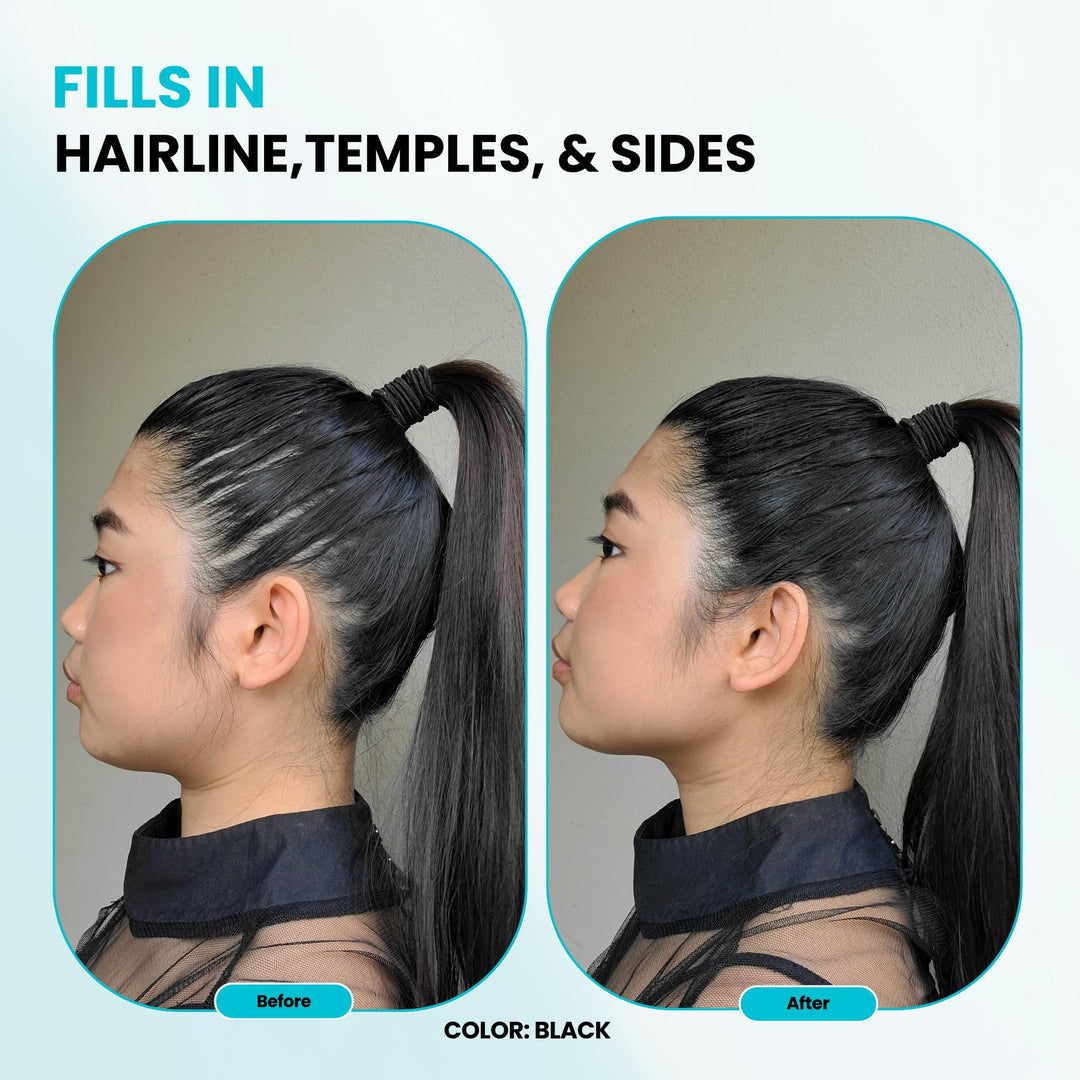 SURETHIK Medium Brown Hair Fibers for Thinning , Building Hair Fibers, Instantly Fuller Looking for Men & Women, 30g