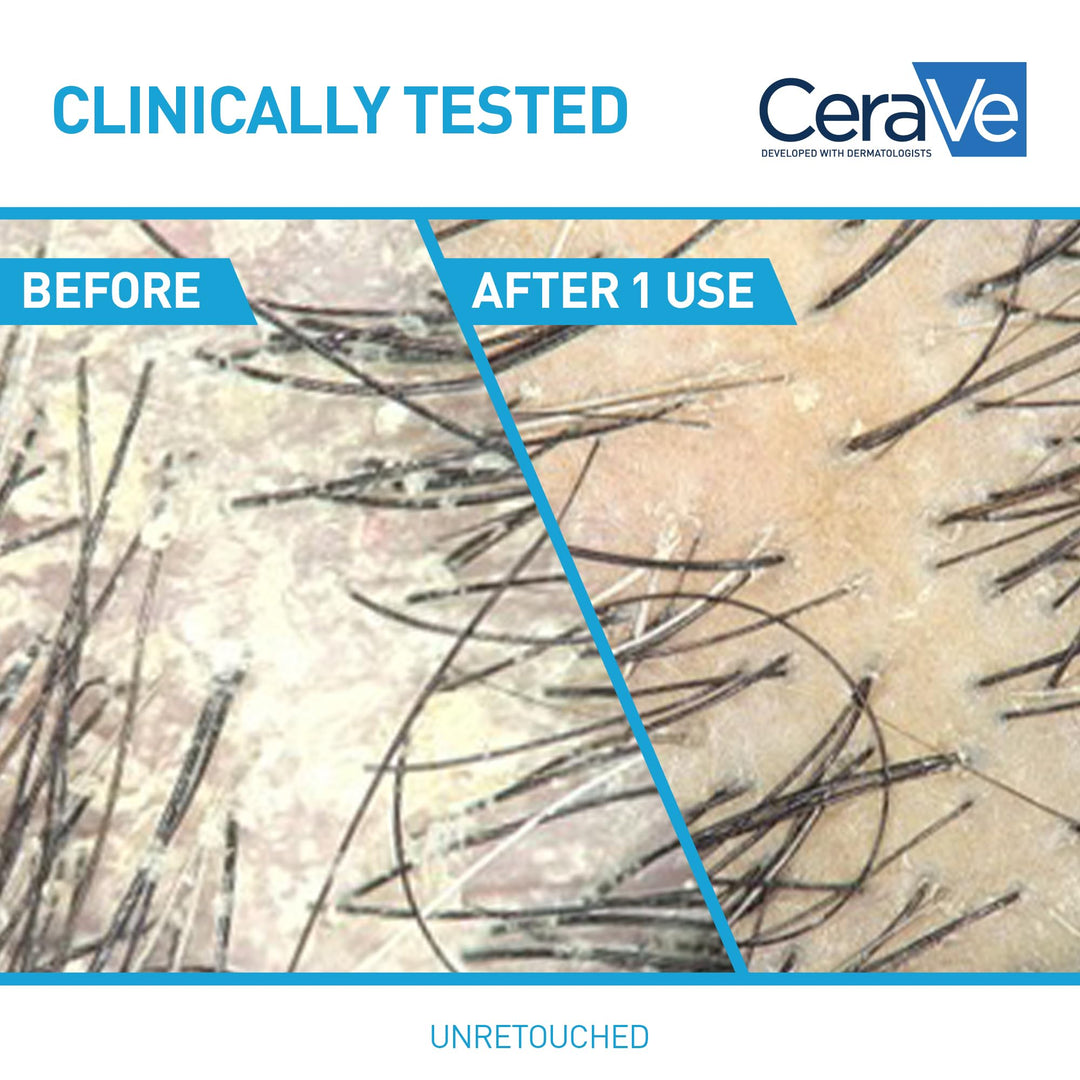 CeraVe 2 In 1 Hydrating Anti Dandruff Shampoo And Conditioner, 1% Pyrithione Zinc Dandruff Treatment, Color Safe & Sulfate Free Shampoo And Conditioner, Helps Eliminate Dandruff & Relieve Itchy Scalp