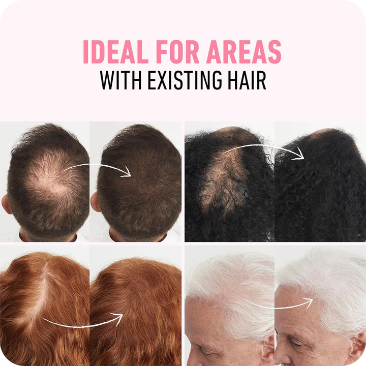 BOLDIFY Hair Fibers | Dark Blonde | Thicker Look for Thinning Hair | 12.5g