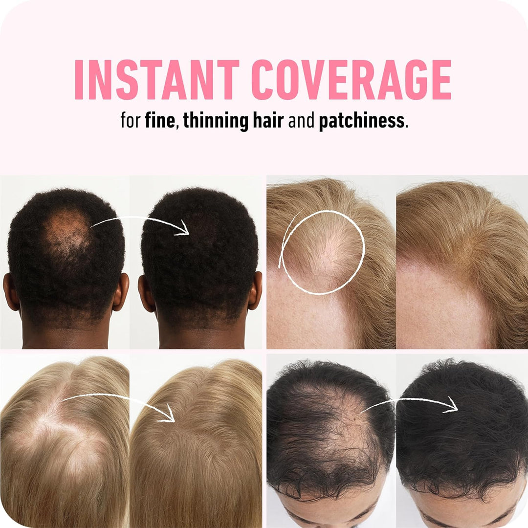 BOLDIFY Hair Fibers | Dark Blonde | Thicker Look for Thinning Hair | 12.5g