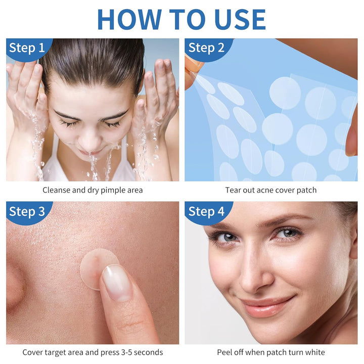 Hydrocolloid Pimple Patches | 510 Count Acne Spot Stickers with Salicylic Acid & Tea Tree Oil