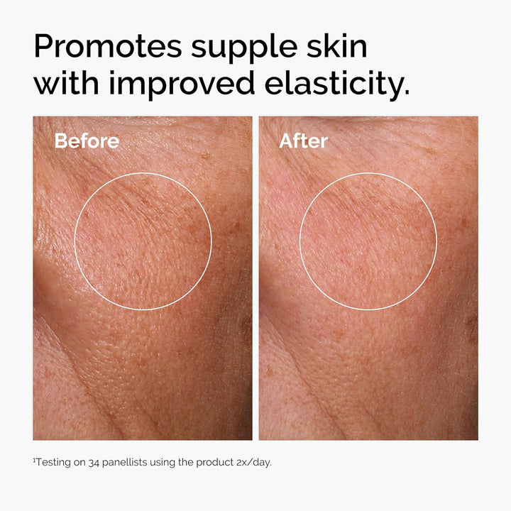 Hyaluronic Acid 2% + B5 Serum | Multi-Depth Hydration for Smoother Skin | 1 Fl Oz