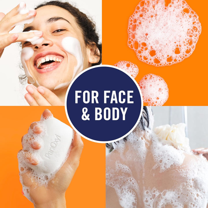 PanOxyl Acne Treatment Bar | 10% Benzoyl Peroxide | Vegan Soap for Acne-Prone Skin | 4 oz
