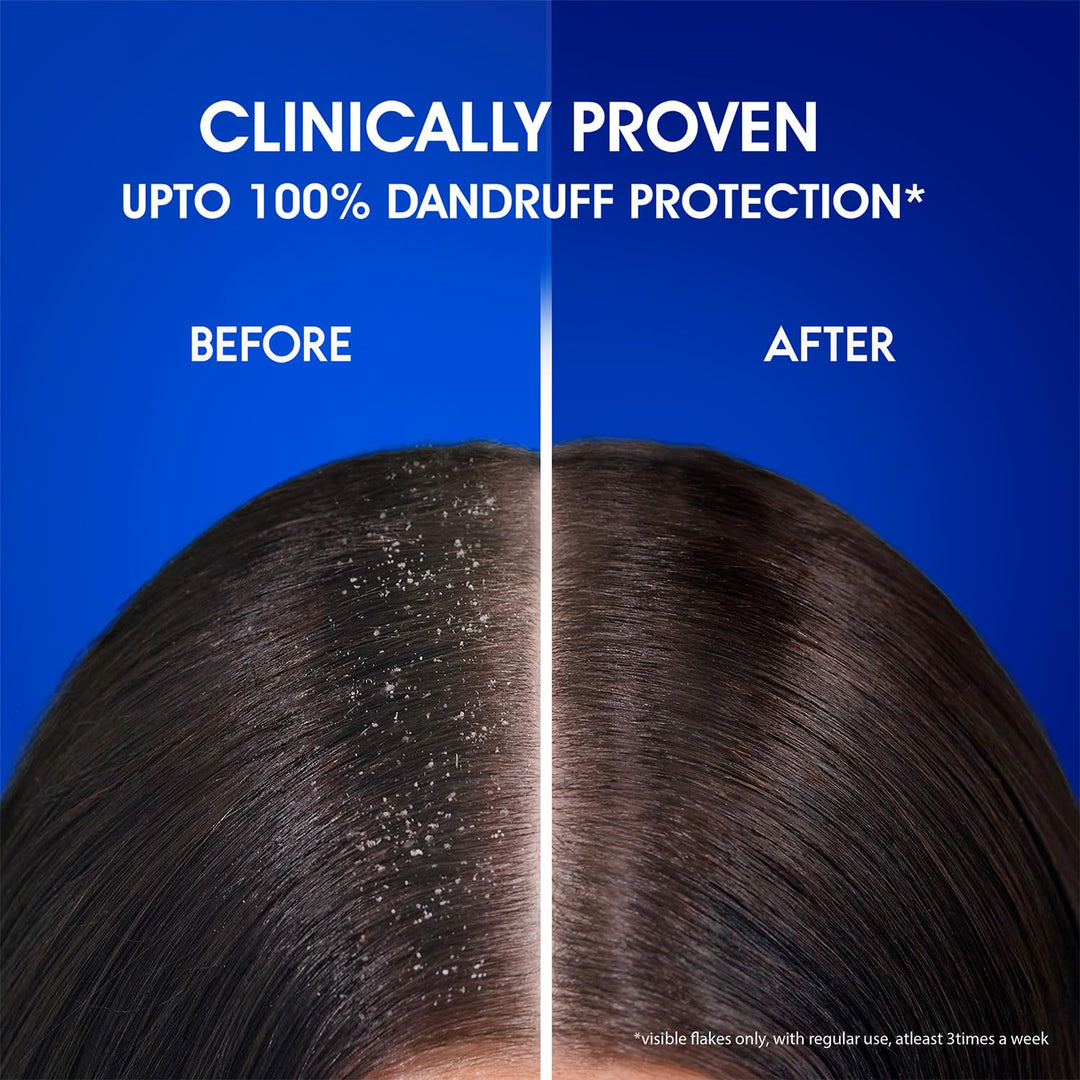 Head & Shoulders Anti Dandruff Cool Menthol Shampoo, 340ml