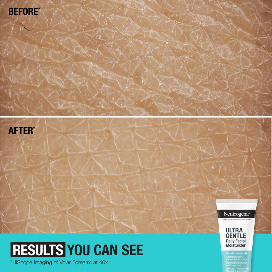 Neutrogena Ultra Gentle Fragrance Free Daily Face Moisturizer, Facial Moisturizer for Sensitive & Dry Skin with CICA, Pro-Vitamin B5, Vitamin E & Niacinamide, 3.4 fl. oz
