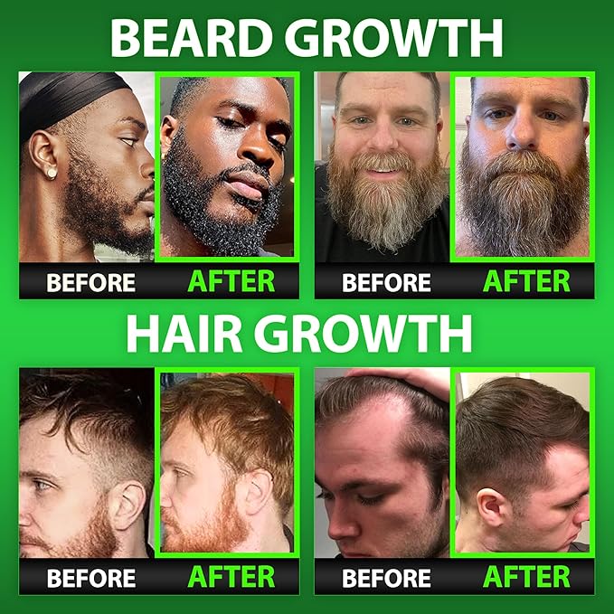 BBS Beard Growth & Hair Growth Vitamins for Men - Maximum Strength 620000mcg Biotin - Collagen - MSM - Keratin - Bamboo Extract - Multivitamin Gummies (Made by Best Beard Stuff USA)