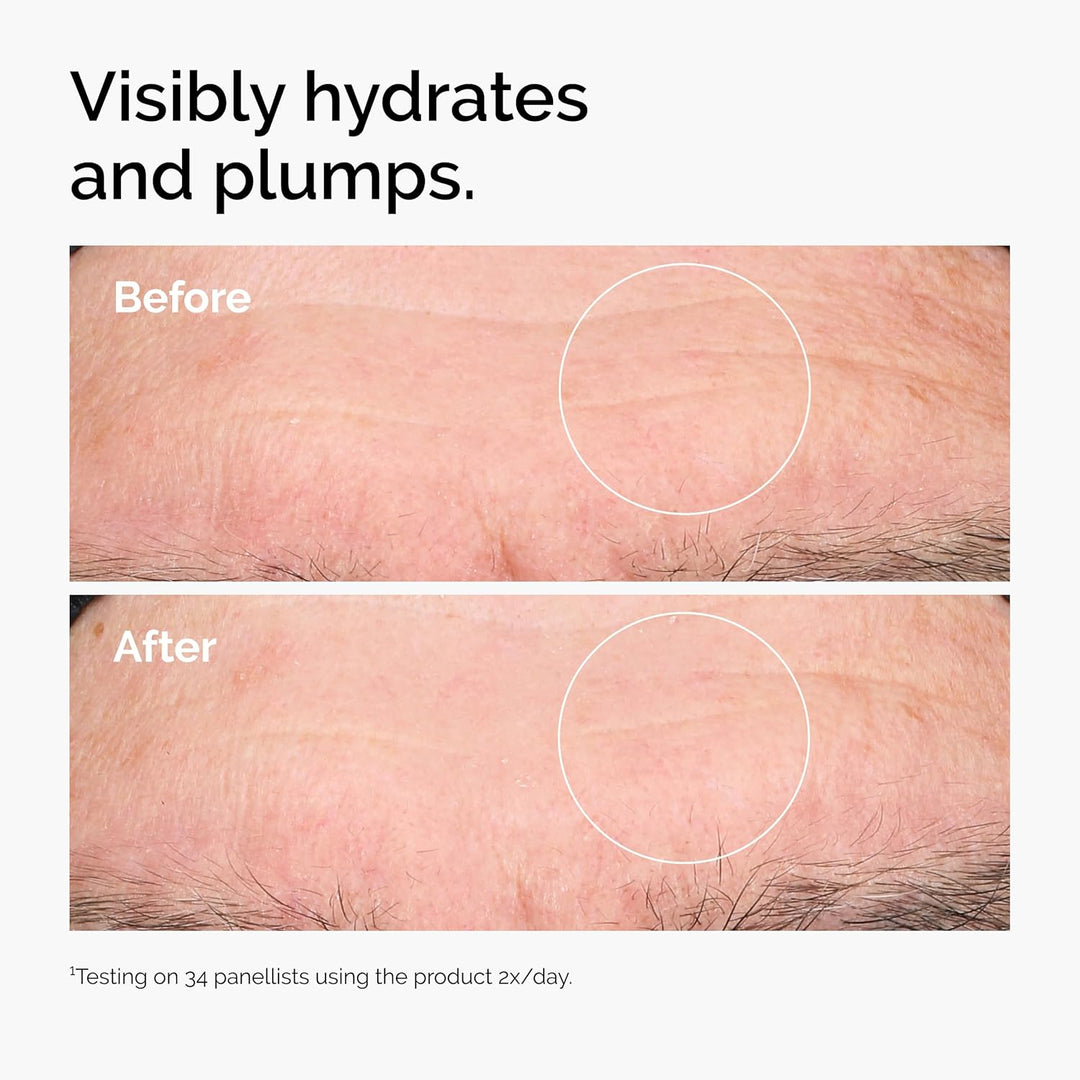 Hyaluronic Acid 2% + B5 Serum | Multi-Depth Hydration for Plumper Skin | 2-Pack