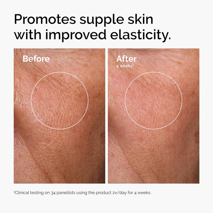 Hyaluronic Acid 2% + B5 Serum | Multi-Depth Hydration for Smoother Skin | 1 Fl Oz