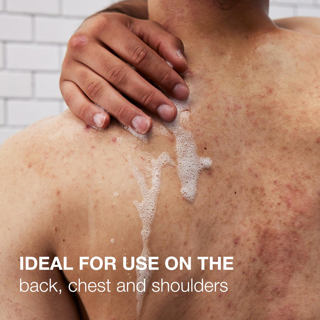 Neutrogena Stubborn Body Acne Cleanser & Exfoliator with Salicylic Acid & PHA for Acne-Prone Skin, Acne Treatment Gently Exfoliates & Helps Prevent Breakouts, Fragrance-Free, 8.5 fl. oz