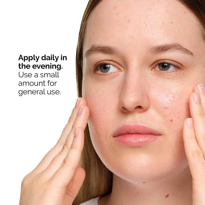 The Ordinary Salicylic Acid 2% Anhydrous Solution, Gentle Exfoliating Serum for Blemish-Prone Skin and Uneven Texture, 1 Fl Oz