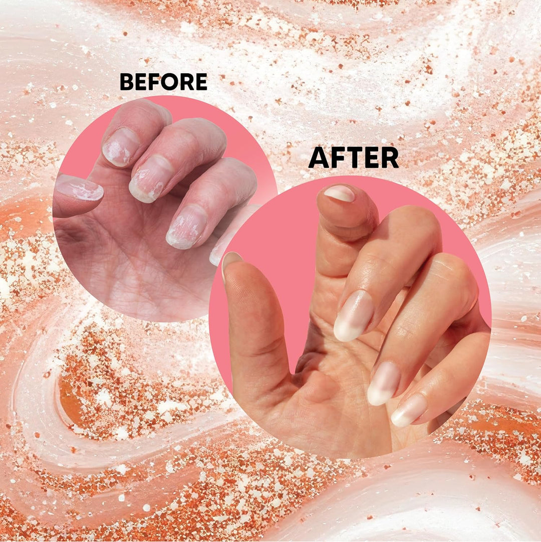 Onyx Hard As Hoof Nail Patches | Strengthening Treatment for Nail Growth - 20 Count