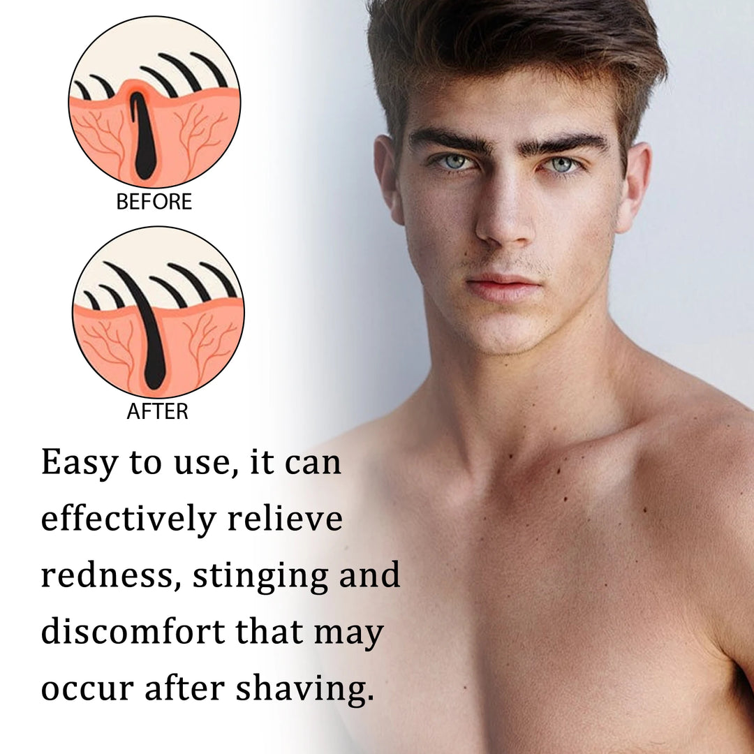 East Moon Eliminates Burn Soothes Redness Deeply Moisturize Skin Men Aftershave Liquid Calms Refreshes After Shave Care Lotion