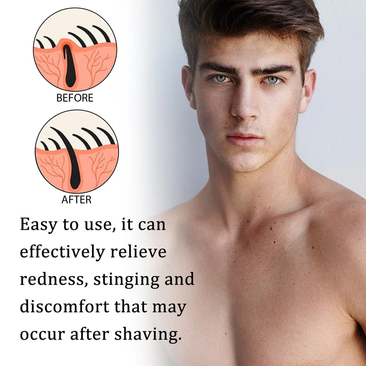 East Moon Eliminates Burn Soothes Redness Deeply Moisturize Skin Men Aftershave Liquid Calms Refreshes After Shave Care Lotion