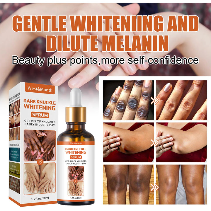 Dark Knuckles Lightening Serum Hand Knuckle Elbows Knee Lighten Oil Intense Stains Remover Products Beauty Care 50ml