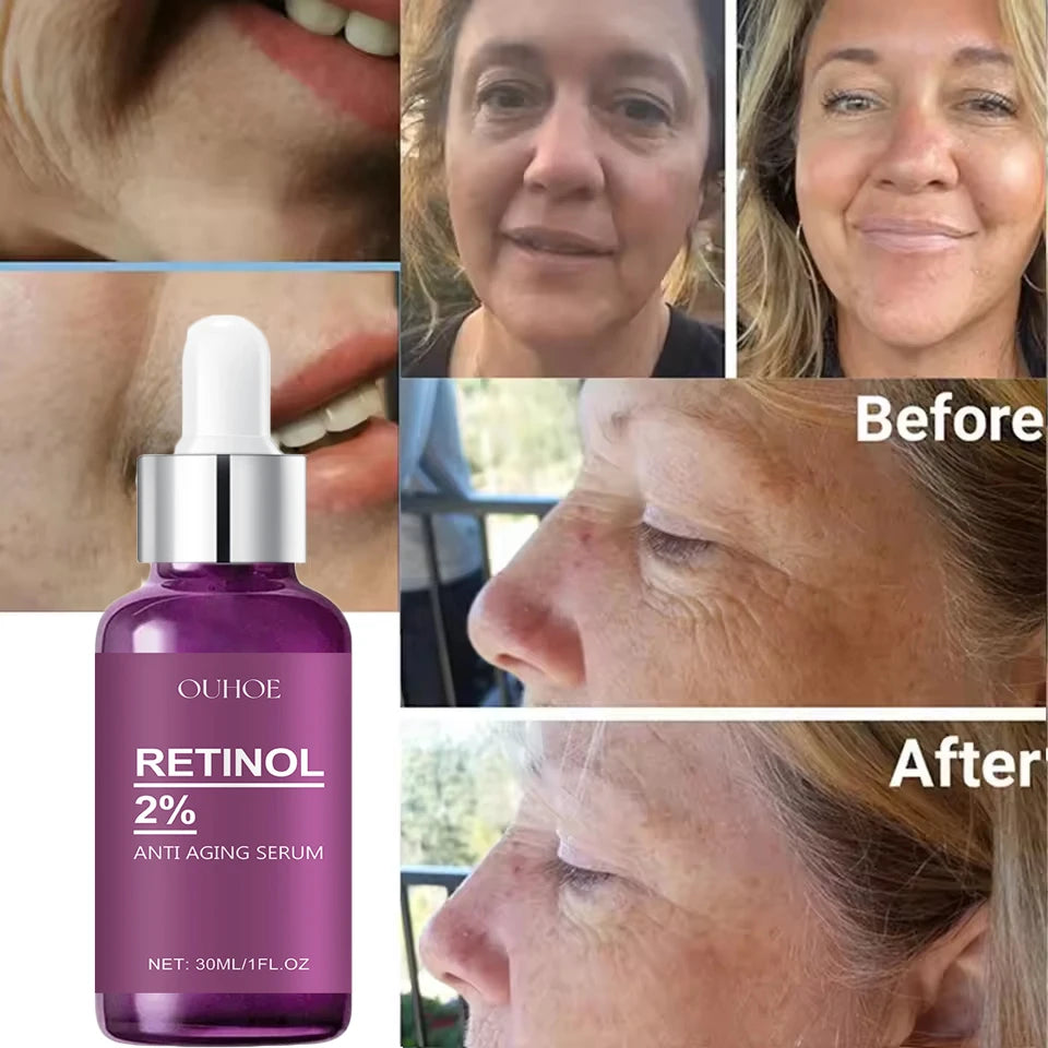 Retinol Remove Wrinkle Face Serum Lift Firming Anti Aging Fade Fine Lines Whitening Brightening Moisturizer Skin Care Cosmetics
