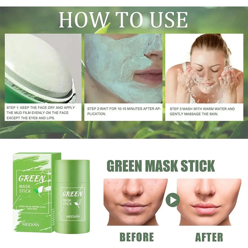 Original Facial Remove Blackhead Green Tea Solid Mask Treat Acne Blemish Black Dots Clean Stick Cream Shrink Pores Skin Care