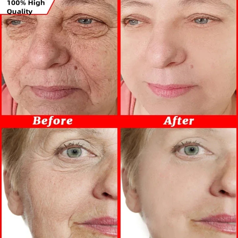 Retinol Wrinkle Remover Facial Serum Set Instant Firming Lift Anti-Aging Cream Fade Fine Lines Whitening Moisturizing Skin Care