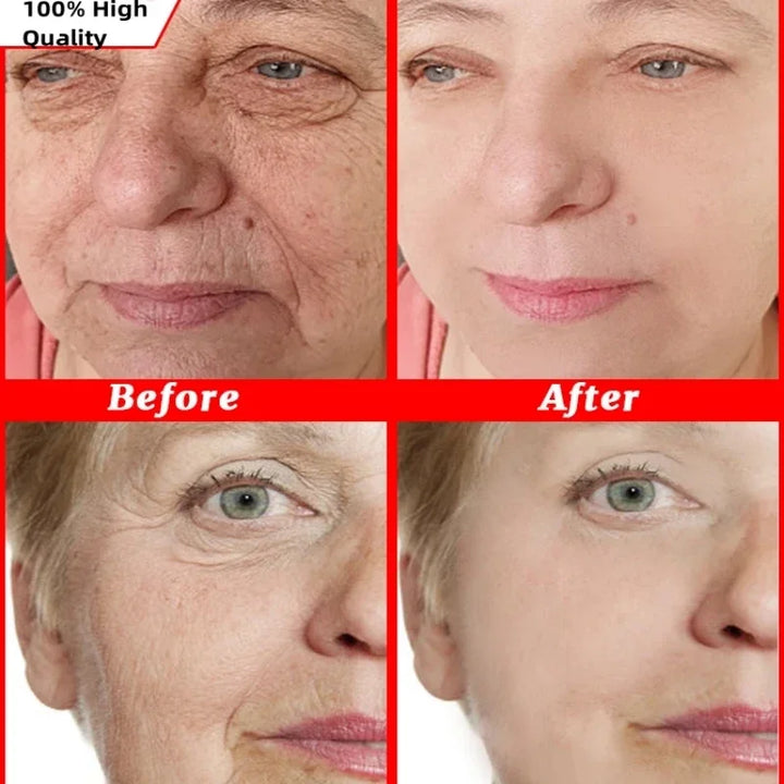 Retinol Wrinkle Remover Facial Serum Set Instant Firming Lift Anti-Aging Cream Fade Fine Lines Whitening Moisturizing Skin Care