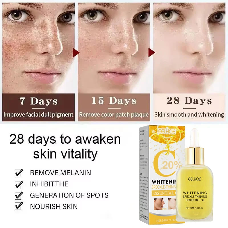 Vitamin C Whitening Freckles Serum Remove Dark Spots Freckles Fade Melanin Nicotinamide Essence Brighten Moisturizing Skin Care