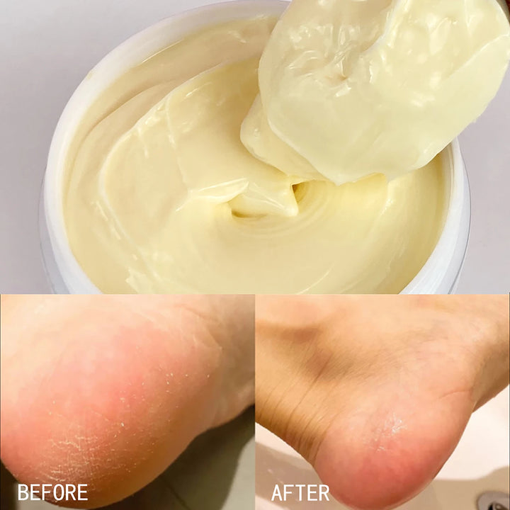 AILKE Whitening Remove Black Spots Facial Skin Care Lotion Moisturizing Cream Body Glutathion Vitamin C Black Skin Face New Set