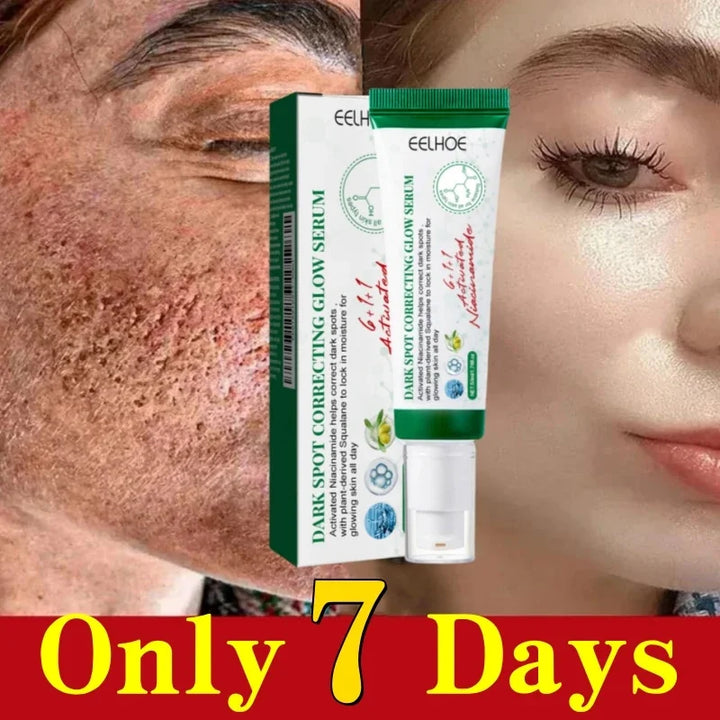 Pore Shrinking Cream Acne Pit Repair Product for Men Women Remove Acne Print Scar Large Pore Anti-inflammatory Smooth Skin Cream