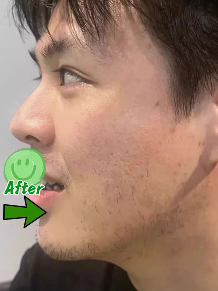 Pore Shrinking Cream Acne Pit Repair Product for Men Women Remove Acne Print Scar Large Pore Anti-inflammatory Smooth Skin Cream