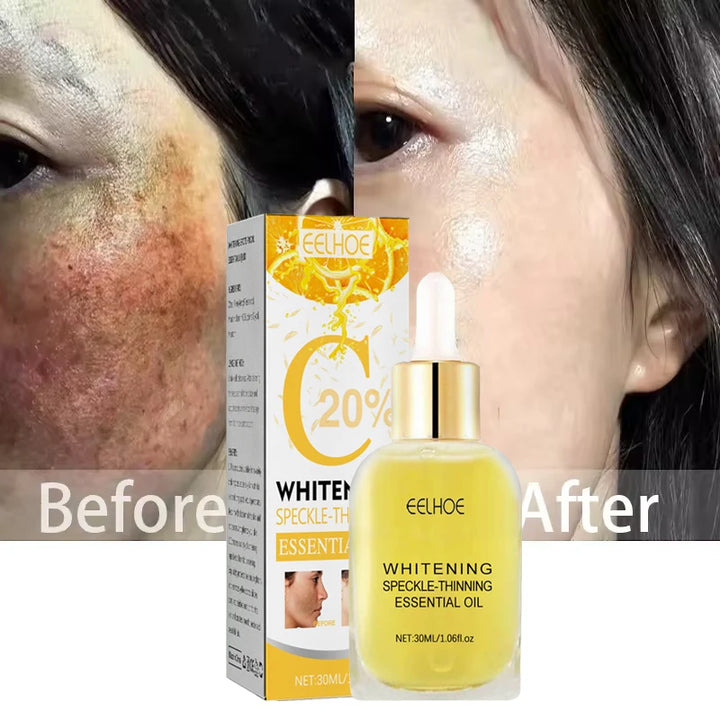 Vitamin C Whitening Freckles Serum Remove Dark Spots Freckles Fade Melanin Nicotinamide Essence Brighten Moisturizing Skin Care