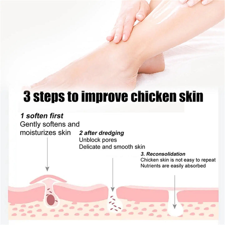 Curing Keratosis Pilaris Chicken Follicle Skin Repair Cream Body Dark Spot Remove Whiten Smooth Moisturize Skincare Body Lotion