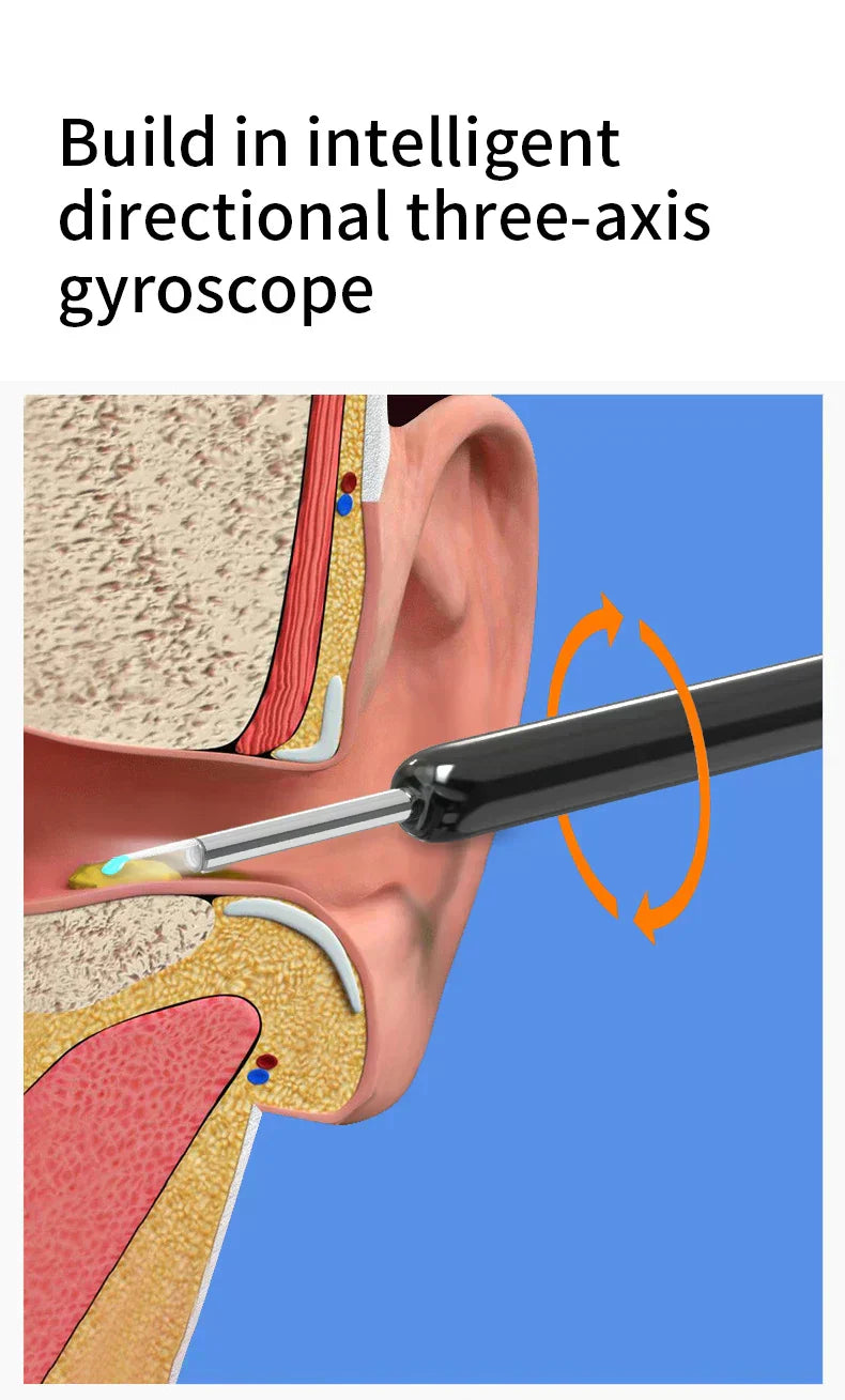 Smart HD Visual Ear Cleaner