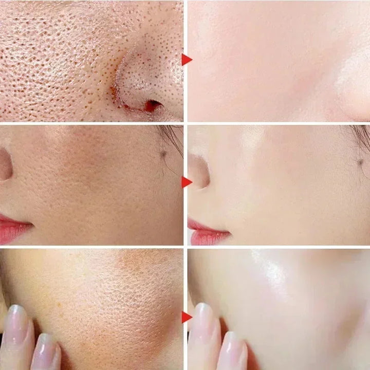 Pore Shrinking Facial Serum Repairing Acne Pit Tighten Large Pores Cream Moisturize Rejuvenation Skin Brighten Whitening Product