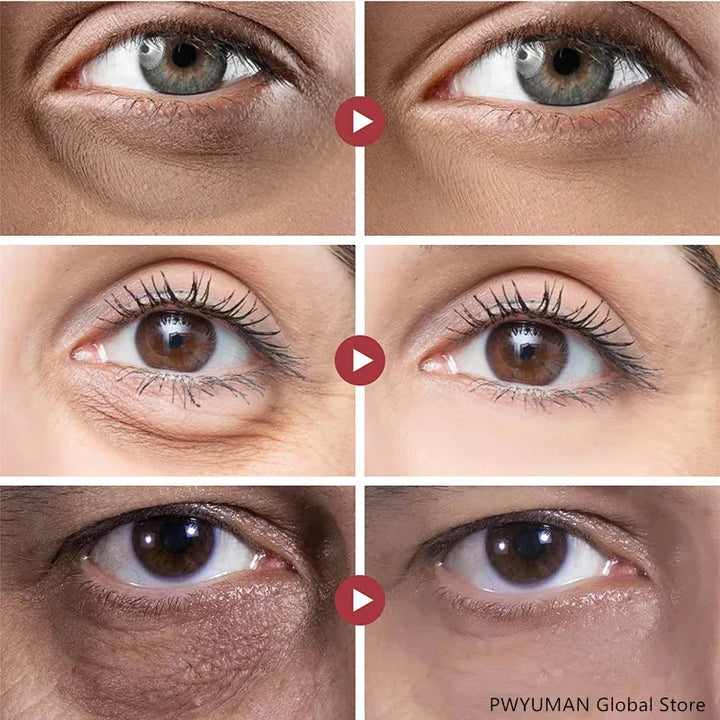 Retinol Anti Wrinkle Eye Serum Peptide Remove Dark Circles Eye Bags Puffiness Cream Moisturizing Repairing Korean Skincare New