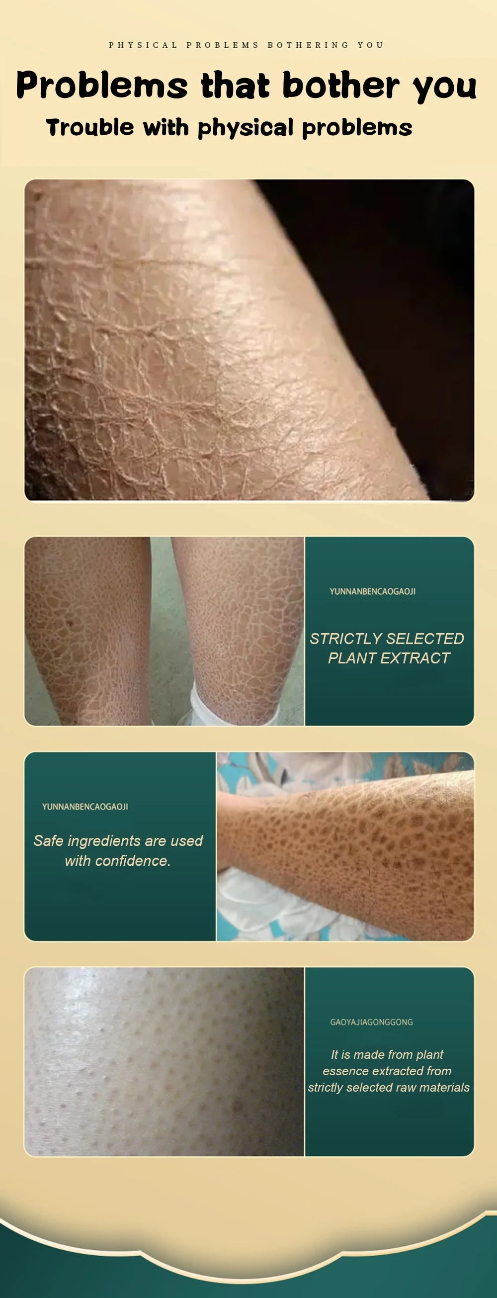 Curing Keratosis Pilaris Chicken Follicle Skin Repair Cream Body Dark Spot Remove Whiten Smooth Moisturize Skincare Body Lotion