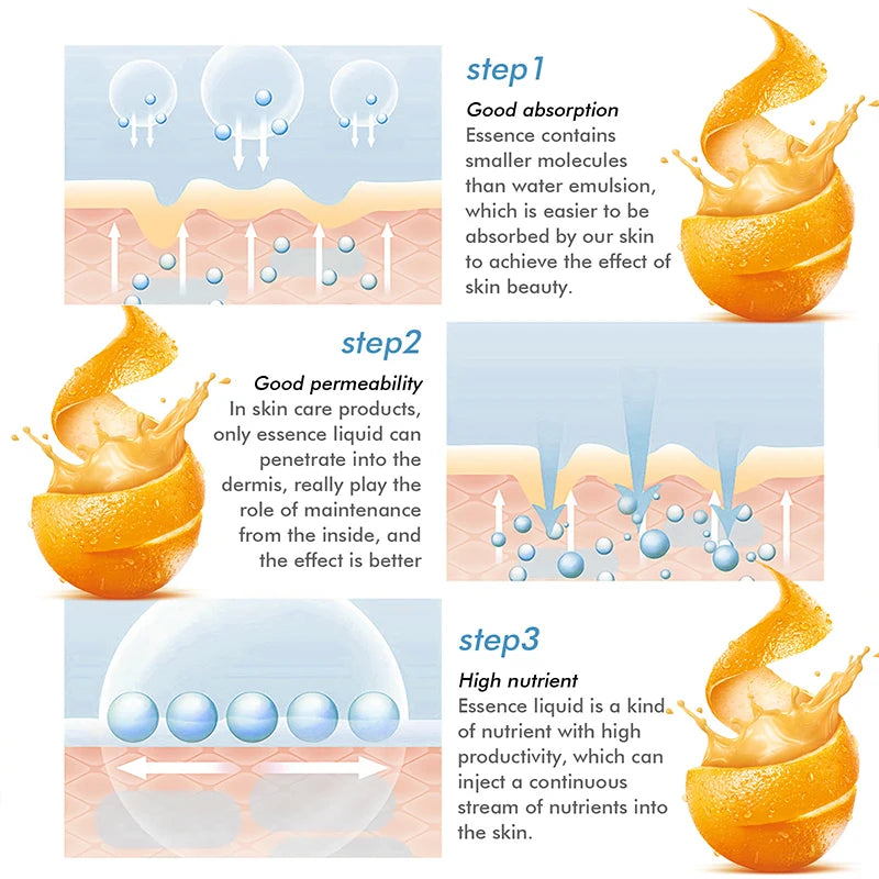 Vitamin C Whitening Freckles Serum Remove Dark Spots Freckles Fade Melanin Nicotinamide Essence Brighten Moisturizing Skin Care