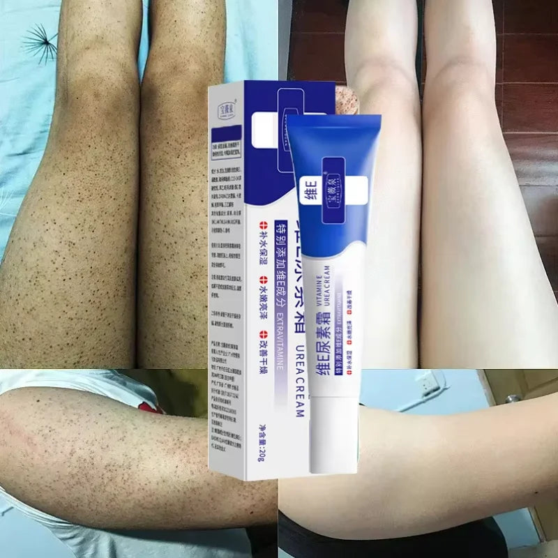 Curing Keratosis Pilaris Chicken Follicle Skin Repair Cream Body Dark Spot Remove Whiten Smooth Moisturize Skincare Body Lotion
