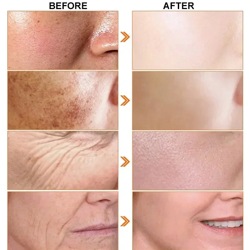 Japan Sakura Wrinkle Remover Face Serum Cream Anti-Aging Fade Fine Lines Lift Firming Vitamin C Whitening Rejuvenation Skin Care