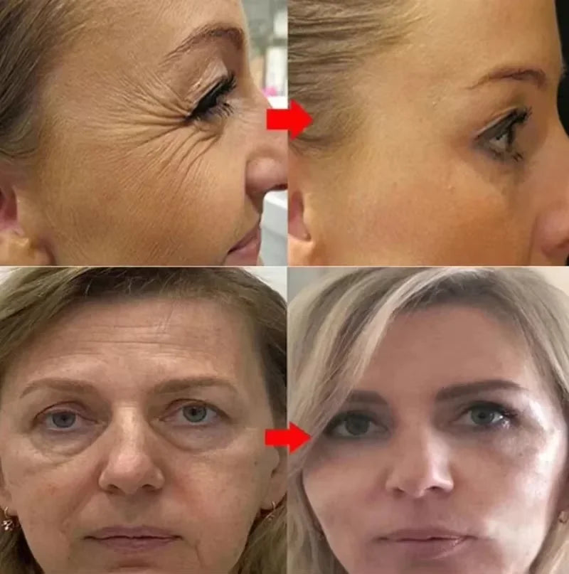 Retinol Remove Wrinkle Face Serum Lift Firming Anti Aging Fade Fine Lines Whitening Brightening Moisturizer Skin Care Cosmetics