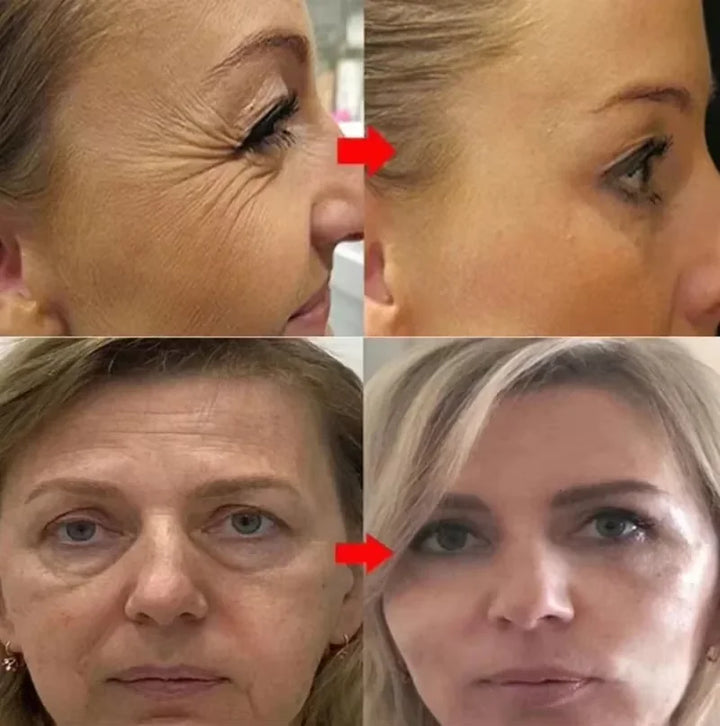 Retinol Remove Wrinkle Face Serum Lift Firming Anti Aging Fade Fine Lines Whitening Brightening Moisturizer Skin Care Cosmetics