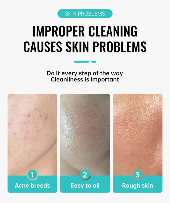 Salicylic Acid Acne Treatment Cream Shrink Pore Remove Blackheads Scars Acne Marks Spots Oil Control Whitening Korean Skin Care