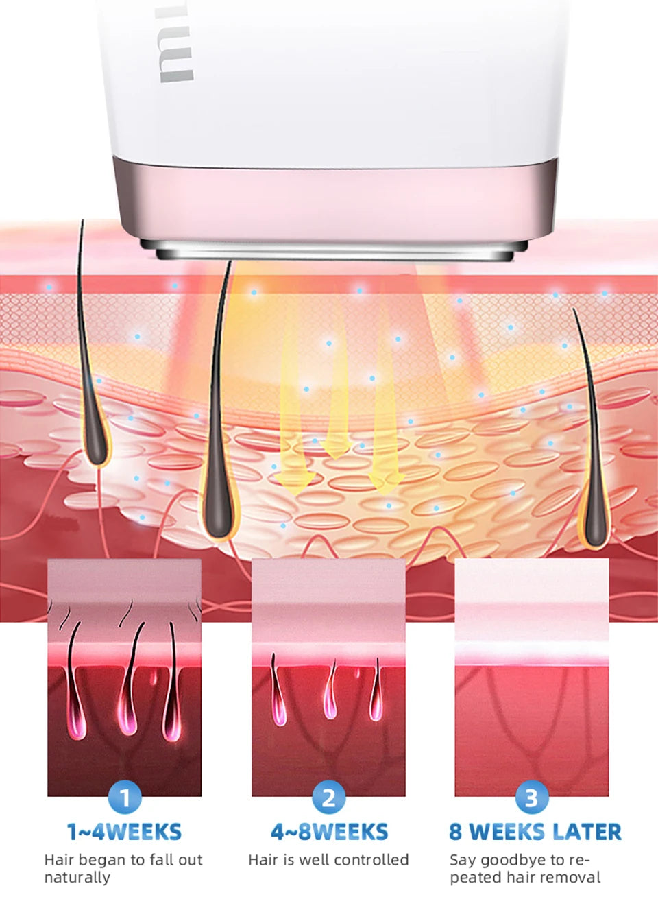 MLAY T4 IPL Laser Hair Removal Machine Ice Cool Permanent Face Body Bikini Epilator With 500000 Shots For Women Men Home Use