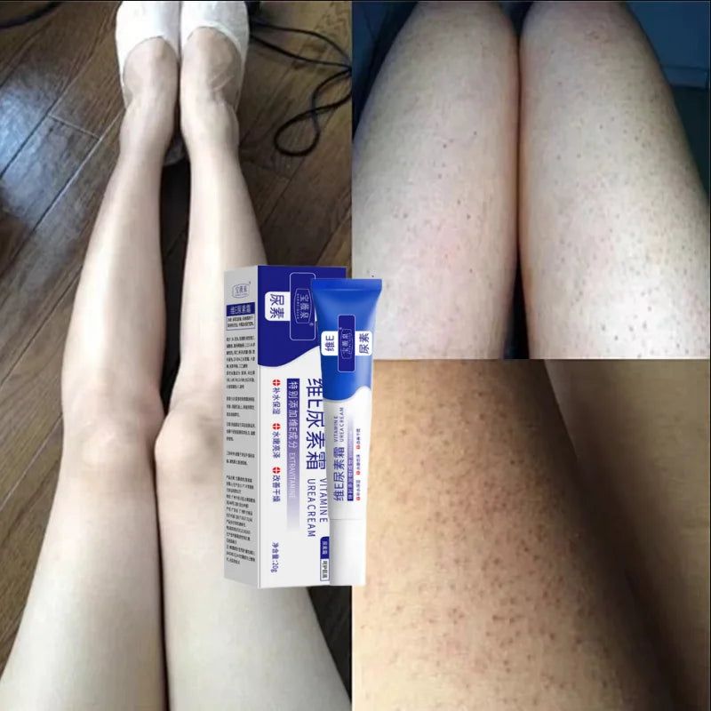 Curing Keratosis Pilaris Chicken Follicle Skin Repair Cream Body Dark Spot Remove Whiten Smooth Moisturize Skincare Body Lotion