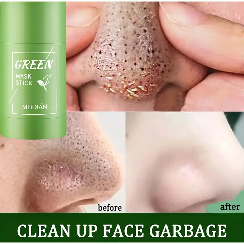 Original Facial Remove Blackhead Green Tea Solid Mask Treat Acne Blemish Black Dots Clean Stick Cream Shrink Pores Skin Care