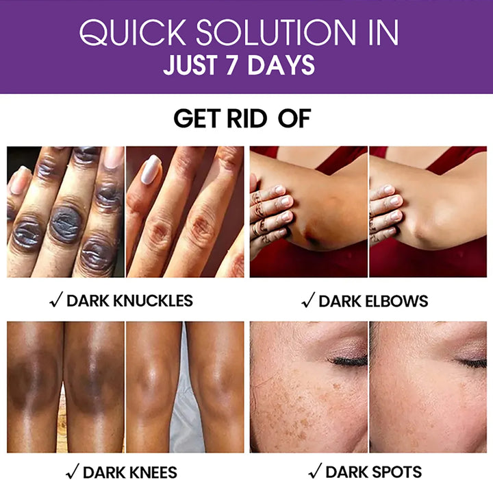 AILKE Anti-Black Spots Intensive Serum, Brightening Serum for an Even & Radiant Complexion, Face Care Against Dark Spots, 120 ml