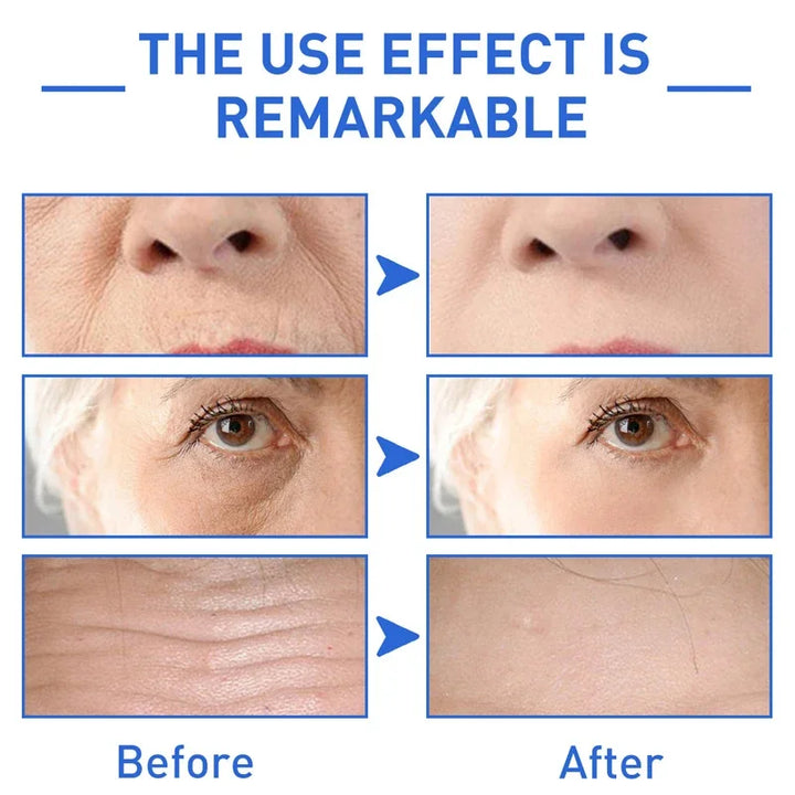 30ml Facial Collagen Serum Whitening Moisturising Fade Fine Lines Anti Wrinkle Anti Ageing Rejuvenate Your Face Cosmetics