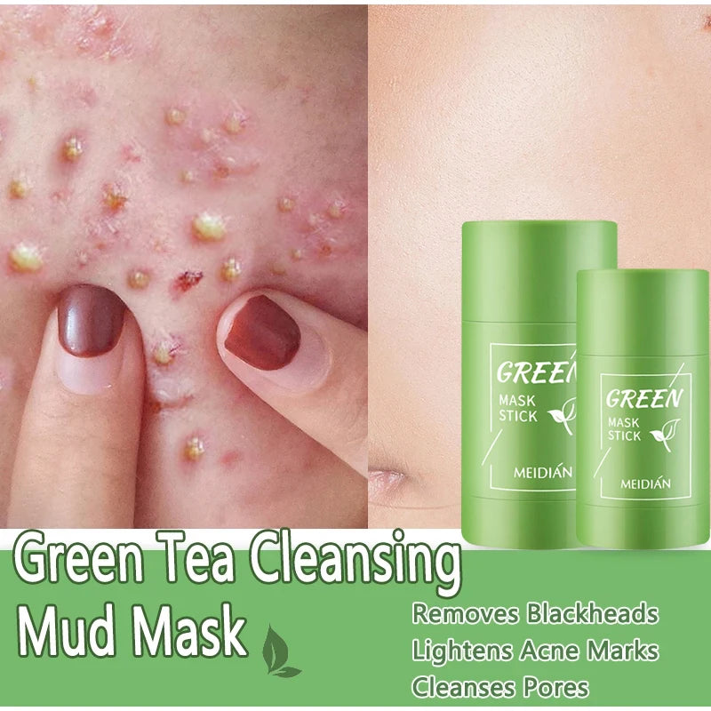 Original Facial Remove Blackhead Green Tea Solid Mask Treat Acne Blemish Black Dots Clean Stick Cream Shrink Pores Skin Care