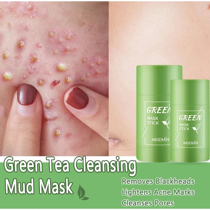 Original Facial Remove Blackhead Green Tea Solid Mask Treat Acne Blemish Black Dots Clean Stick Cream Shrink Pores Skin Care