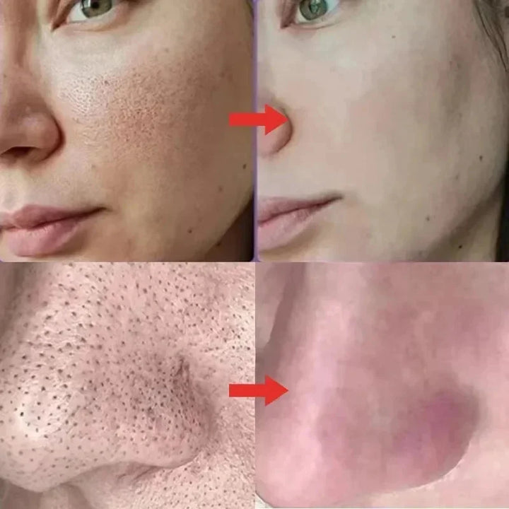 Pore Shrinking Facial Serum Repairing Acne Pit Tighten Large Pores Cream Moisturize Rejuvenation Skin Brighten Whitening Product