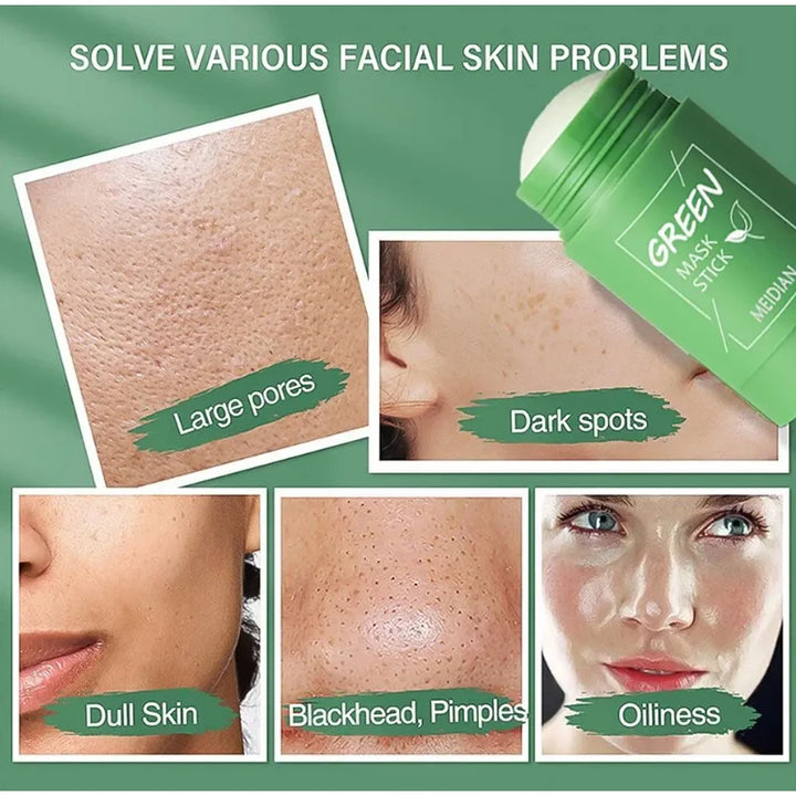 Original Facial Remove Blackhead Green Tea Solid Mask Treat Acne Blemish Black Dots Clean Stick Cream Shrink Pores Skin Care