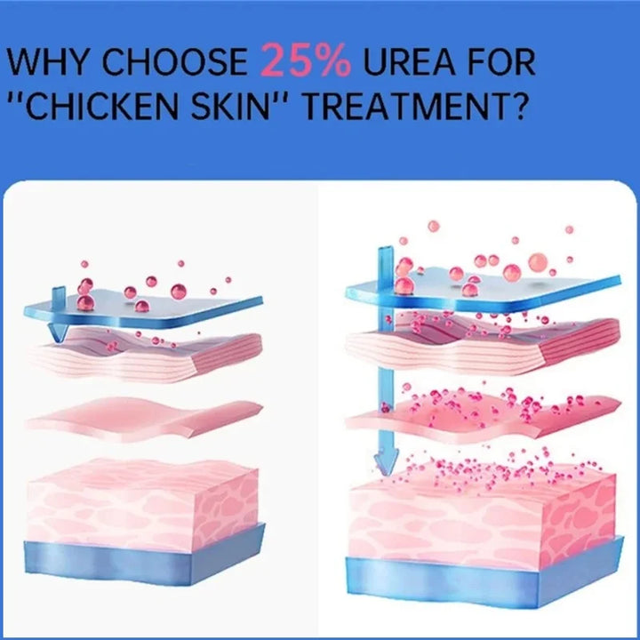 Curing Keratosis Pilaris Chicken Follicle Skin Repair Cream Body Dark Spot Remove Whiten Smooth Moisturize Skincare Body Lotion