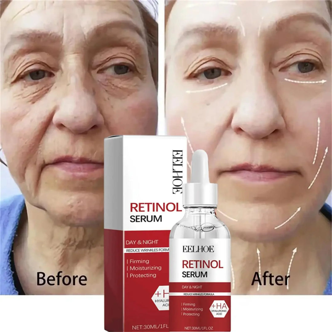 Retinol Wrinkle Remover Facial Serum Set Instant Firming Lift Anti-Aging Cream Fade Fine Lines Whitening Moisturizing Skin Care