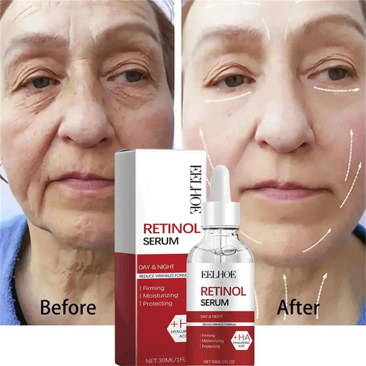 Retinol Wrinkle Remover Facial Serum Set Instant Firming Lift Anti-Aging Cream Fade Fine Lines Whitening Moisturizing Skin Care